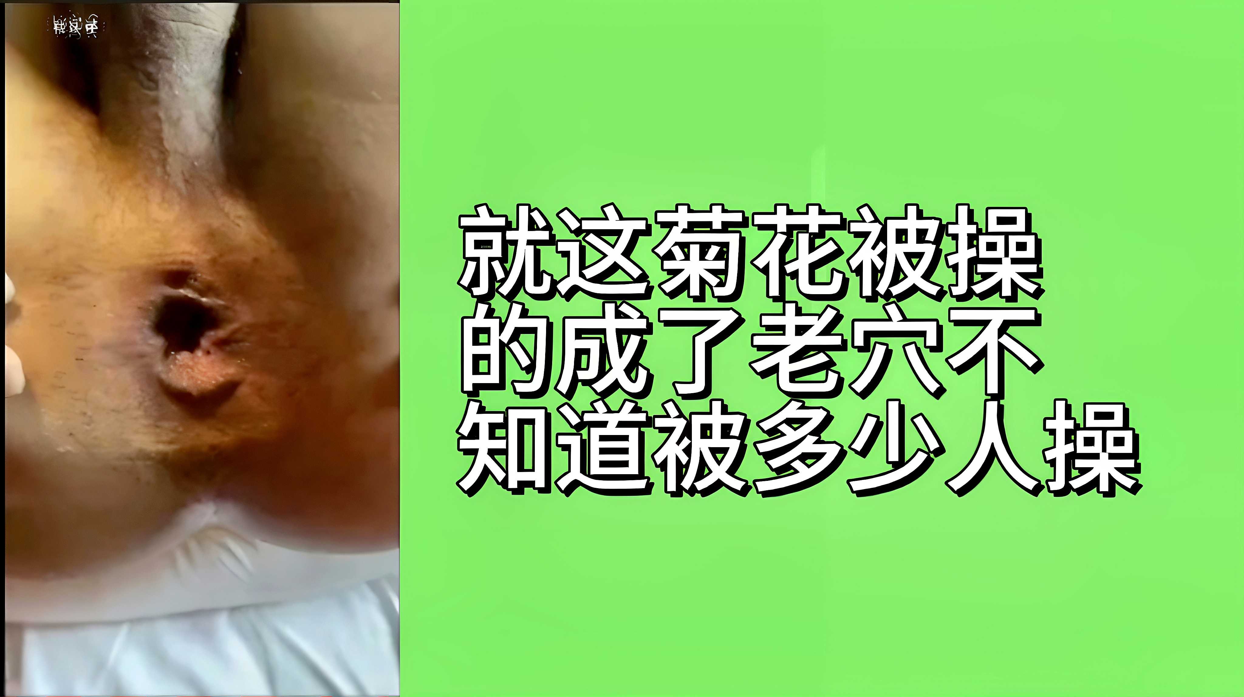 就这菊花被操成老穴不知道被多少人操