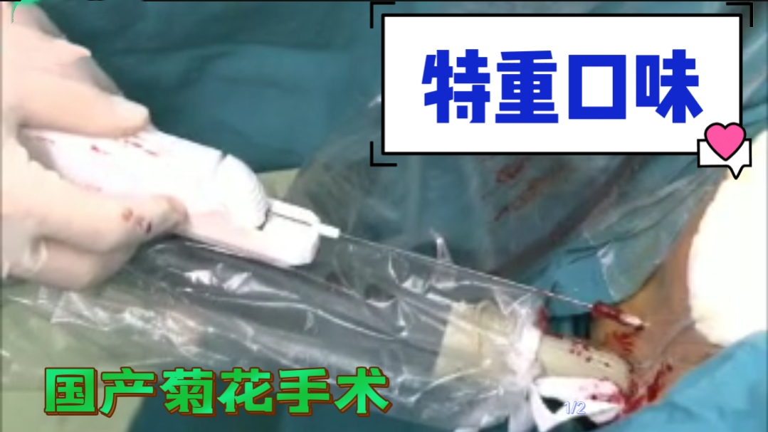 特重口味国产菊花手术